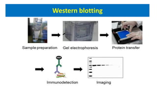 Western blotting
 