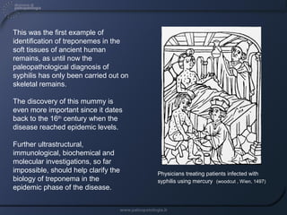 Paleopathology Examples Ancient Remnants: Biomolecules in Paleopathology | PPT