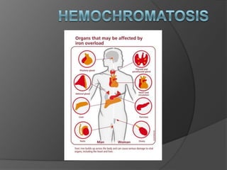 Hemochromatosis 