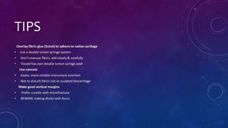 TIPS
Overlay fibrin glue (Evicel) to adhere to native cartilage
• Use a double lumen syringe system
• Don’t overuse fibrin, add slowly & carefully
• Tisseel has own double lumen syringe avail
Use cannula
• Easier, more reliable instrument insertion
• Not to disturb fibrin clot or sculpted biocartilage
Make good vertical margins
• Prefer curette with microfracture
• BEWARE making divots with burrs
 