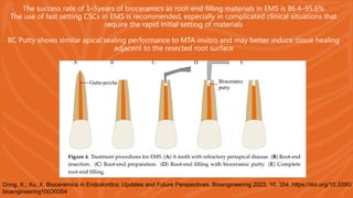 Comprehensive Overview of Bioceramics in Endodontics: History ...