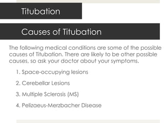 Causes of Titubation The following medical conditions are some of the possible causes of Titubation. There are likely to be other possible causes, so ask your doctor about your symptoms.   1. Space-occupying lesions 2. Cerebellar Lesions 3. Multiple Sclerosis (MS) 4. Pelizaeus-Merzbacher Disease Titubation 