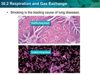 Smoking is the leading cause of lung diseases.  