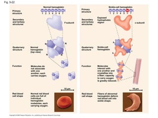 Fig. 5-22 Primary structure Secondary and tertiary structures Quaternary structure Normal hemoglobin (top view) Primary structure Secondary and tertiary structures Quaternary structure Function Function    subunit Molecules do not associate with one another; each carries oxygen. Red blood cell shape Normal red blood cells are full of individual hemoglobin moledules, each carrying oxygen. 10 µm Normal hemoglobin     1 2 3 4 5 6 7 Val His Leu Thr Pro Glu Glu Red blood cell shape    subunit Exposed hydrophobic region Sickle-cell hemoglobin   Molecules interact with one another and crystallize into a fiber; capacity to carry oxygen is greatly reduced.   Fibers of abnormal hemoglobin deform red blood cell into sickle shape. 10 µm Sickle-cell hemoglobin Glu Pro Thr Leu His Val Val 1 2 3 4 5 6 7 