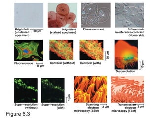 Figure 6.3
50 µm
10 µm
50µm
10µm
1µm
2 µm 2 µm
Brightfield
(unstained
specimen)
Brightfield
(stained specimen)
Phase-contrast Differential-
interference-contrast
(Nomarski)
Fluorescence Confocal (without) Confocal (with)
Deconvolution
Super-resolution
(without)
Super-resolution
(with)
Scanning
electron
microscopy (SEM)
Transmission
electron
microscopy (TEM)
 