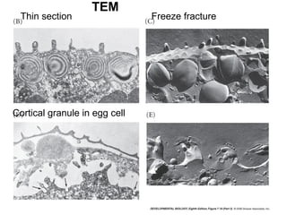 Thin section Freeze fracture
Cortical granule in egg cell
TEM
 
