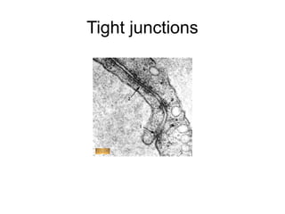 Tight junctions
 