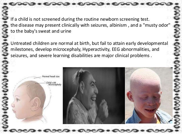phenylketonuria
Phenylketonuria Disease