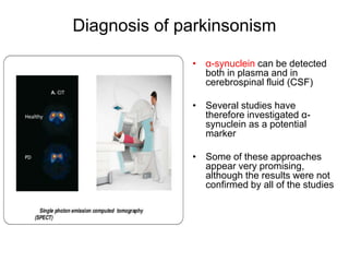Diagnosis of parkinsonism
• α-synuclein can be detected
both in plasma and in
cerebrospinal fluid (CSF)
• Several studies have
therefore investigated α-
synuclein as a potential
marker
• Some of these approaches
appear very promising,
although the results were not
confirmed by all of the studies
 