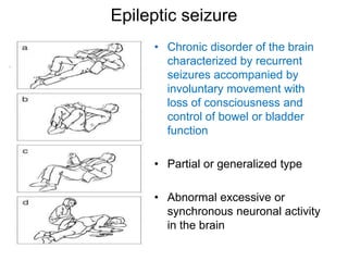 Epileptic seizure
• Chronic disorder of the brain
characterized by recurrent
seizures accompanied by
involuntary movement with
loss of consciousness and
control of bowel or bladder
function
• Partial or generalized type
• Abnormal excessive or
synchronous neuronal activity
in the brain
 