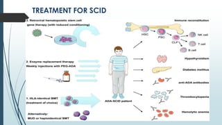 TREATMENT FOR SCID
 