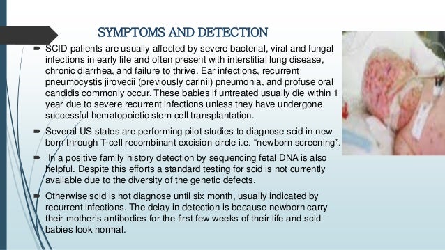 scid causes scid causes