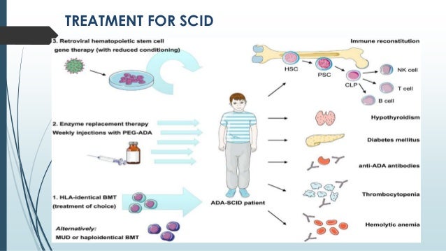 scid causes scid causes