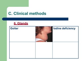 Biochemical and clinical Nutrition Assessment.pptx