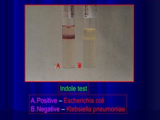 Indole Negative Urease Positive Biochemical identification of bacteria | PPT