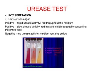 Biochemical Identification of bacteria 2023 sk.ppt | Blood Disorders ...
