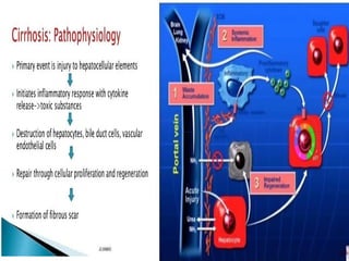 Comprehensive Overview of Liver Cirrhosis and Hepatic Failure: Symptoms ...