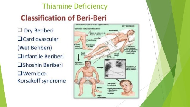 thiamine and genetic beriberi Beriberi is caused by a deficiency of thiamine (vitamin b1), which in turn causes neurological, mental, and cardiovascular problems. thiamine and genetic beriberi Beriberi is caused by a deficiency of thiamine (vitamin b1), which in turn causes neurological, mental, and cardiovascular problems.