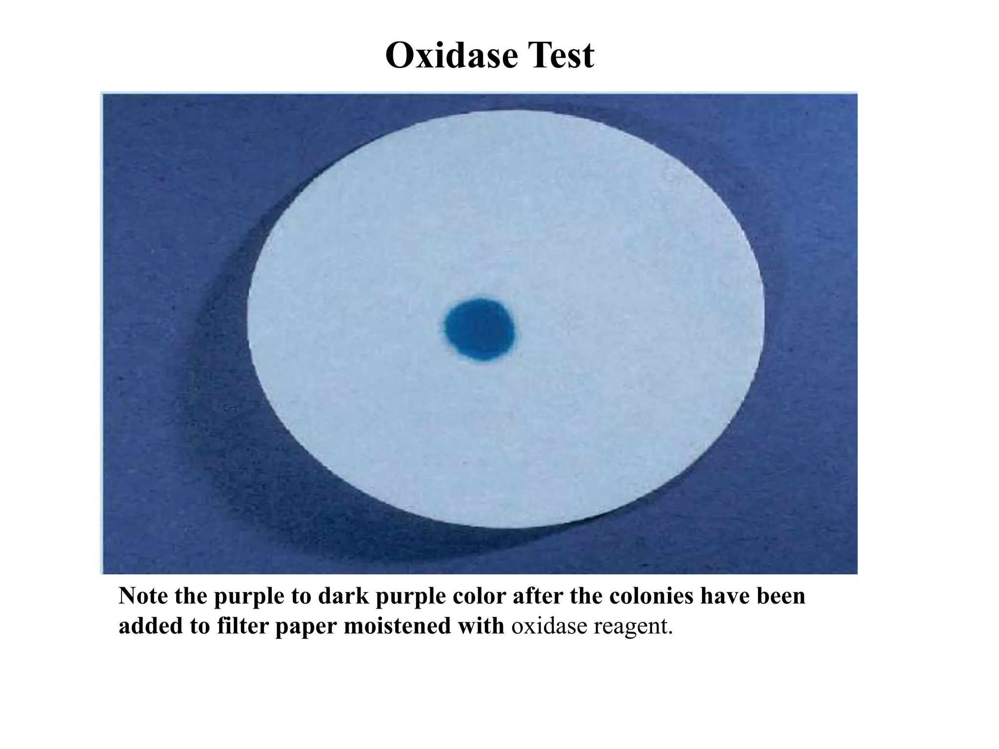 Note the purple to dark purple color after the colonies have been
added to filter paper moistened with oxidase reagent.
Oxidase Test
 