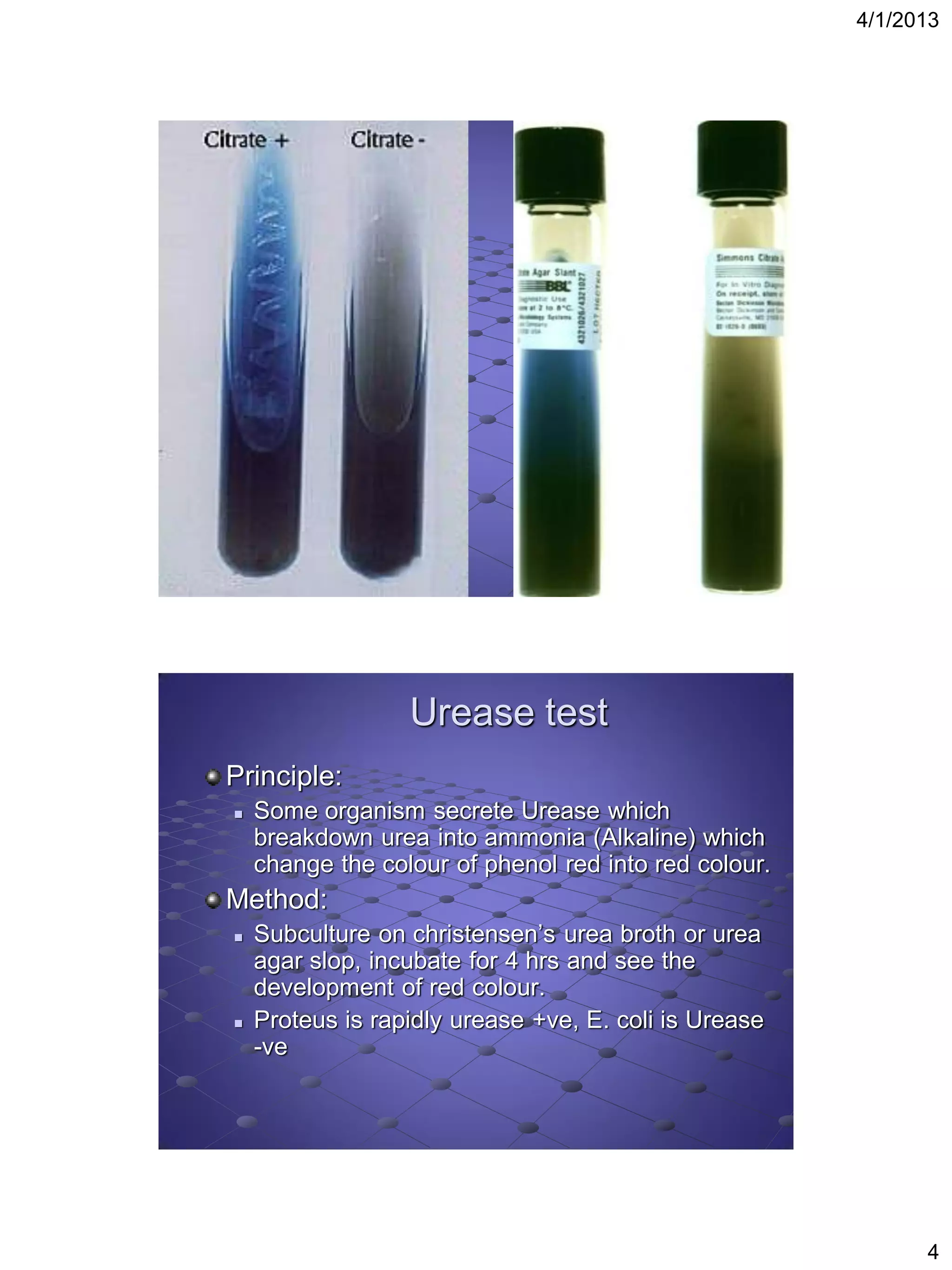 4/1/2013




                  Urease test
Principle:
   Some organism secrete Urease which
    breakdown urea into ammonia (Alkaline) which
    change the colour of phenol red into red colour.
Method:
   Subculture on christensen’s urea broth or urea
    agar slop, incubate for 4 hrs and see the
    development of red colour.
   Proteus is rapidly urease +ve, E. coli is Urease
    -ve




                                                             4
 
