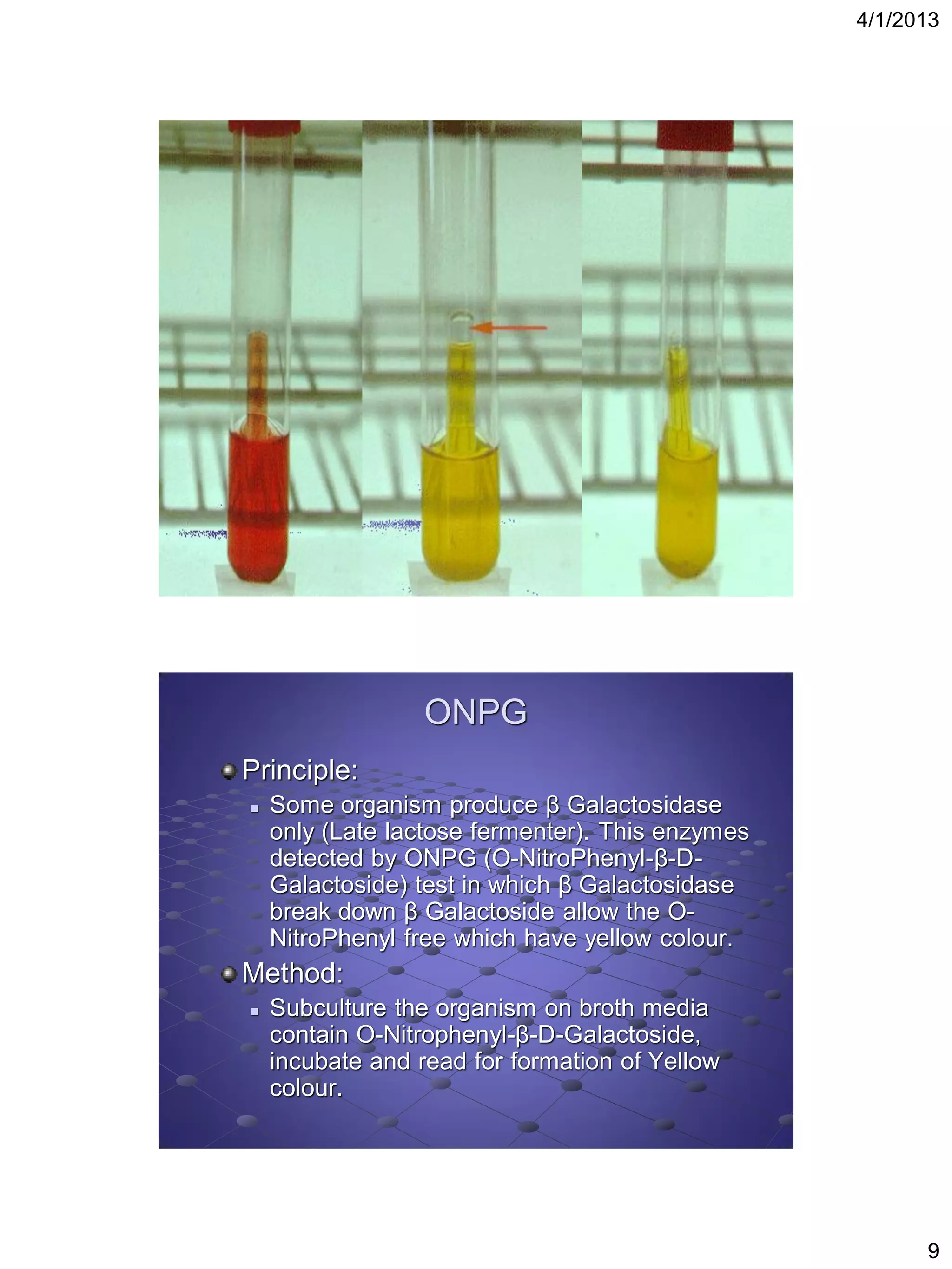 4/1/2013




                  ONPG
Principle:
   Some organism produce β Galactosidase
    only (Late lactose fermenter). This enzymes
    detected by ONPG (O-NitroPhenyl-β-D-
    Galactoside) test in which β Galactosidase
    break down β Galactoside allow the O-
    NitroPhenyl free which have yellow colour.
Method:
   Subculture the organism on broth media
    contain O-Nitrophenyl-β-D-Galactoside,
    incubate and read for formation of Yellow
    colour.




                                                        9
 
