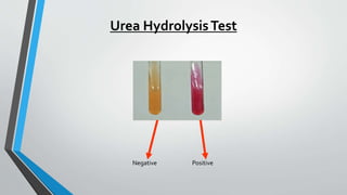 Urea HydrolysisTest
Negative Positive
 
