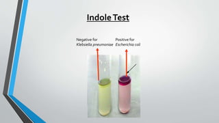 Positive for
Escherichia coli
Negative for
Klebsiella pneumoniae
IndoleTest
 