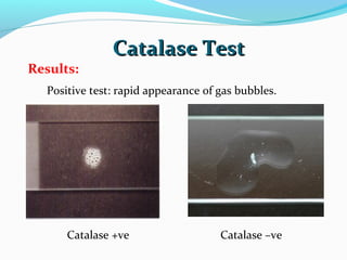 catalase test - principle, procedure, results, uses &... Biochemical Reaction - Prac. Microbiology | PPT