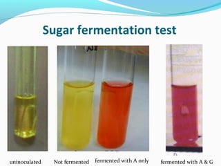 Biochemical Reaction - Prac. Microbiology | PPT