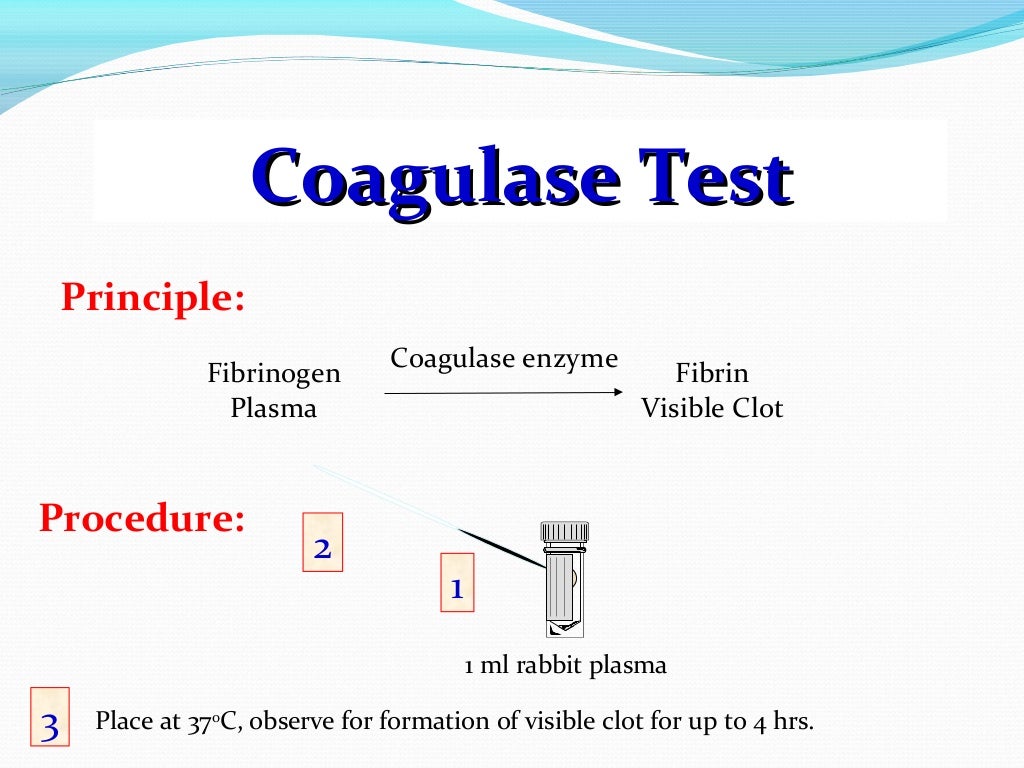 Biochemical Reaction Prac. Microbiology