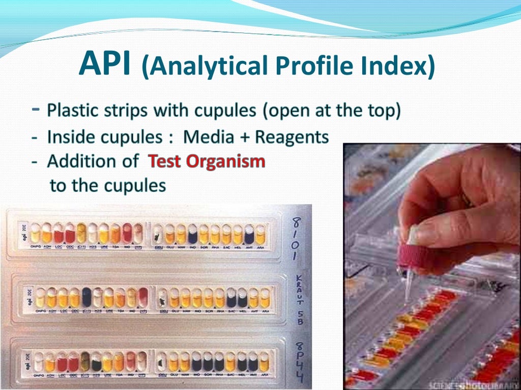 Biochemical Reaction Prac. Microbiology