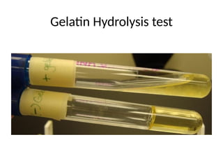 Gelatin Hydrolysis test
 