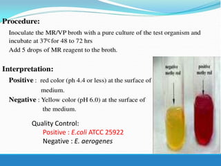 Quality Control:
Positive : E.coli ATCC 25922
Negative : E. aerogenes
OC
 