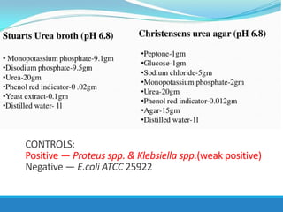 CONTROLS:
Positive — Proteus spp. & Klebsiella spp.(weak positive)
Negative — E.coli ATCC 25922
 