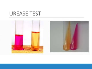 UREASE TEST
 