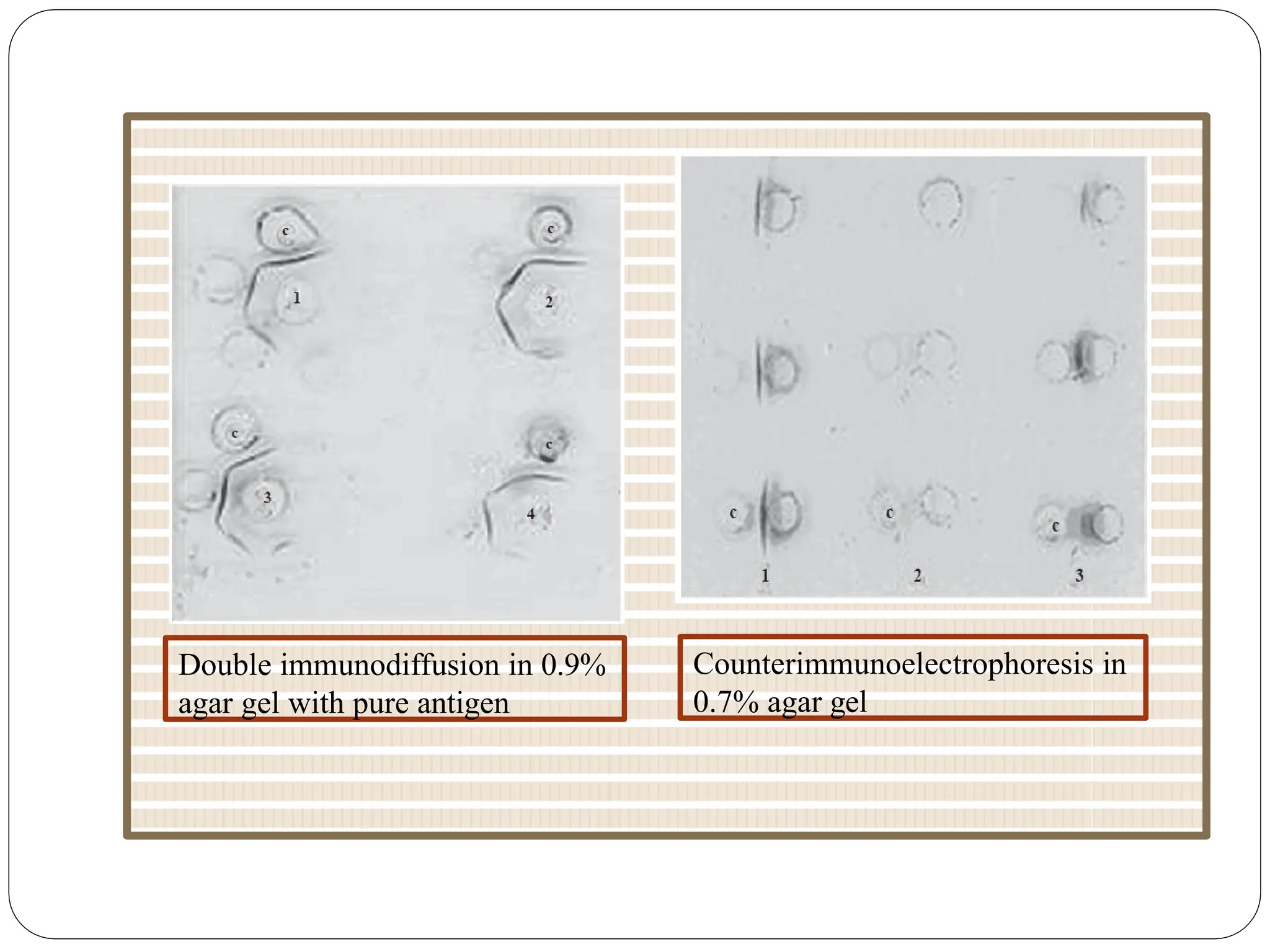Counterimmunoelectrophoresis in
0.7% agar gel
Double immunodiffusion in 0.9%
agar gel with pure antigen
 