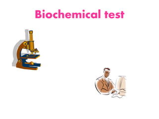 Biochemical test
 