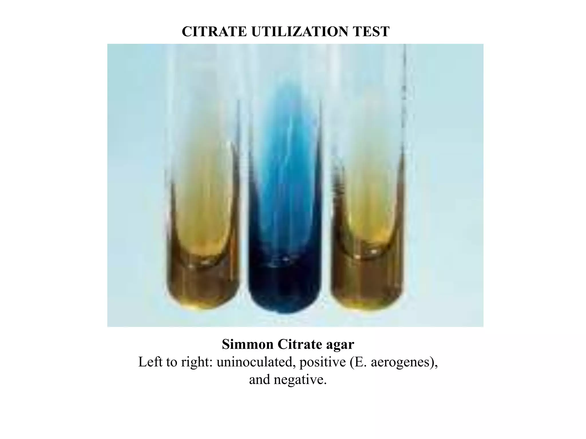 CITRATE UTILIZATION TEST




                Simmon Citrate agar
Left to right: uninoculated, positive (E. aerogenes),
                    and negative.
 