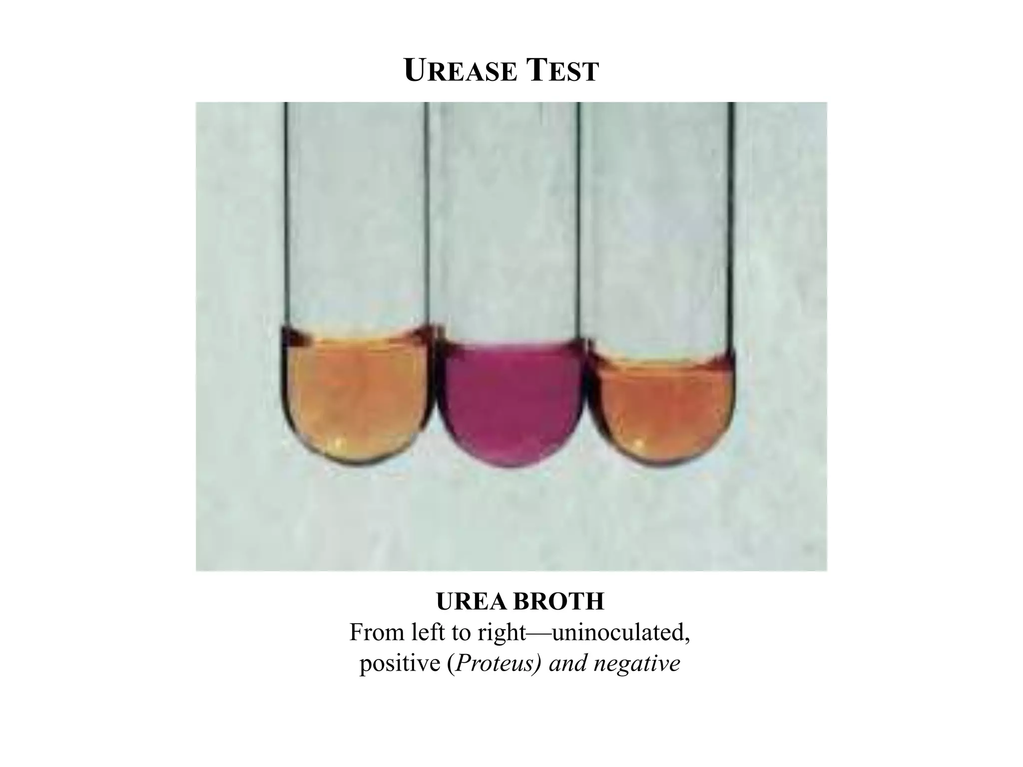 UREASE TEST




         UREA BROTH
From left to right—uninoculated,
 positive (Proteus) and negative
 