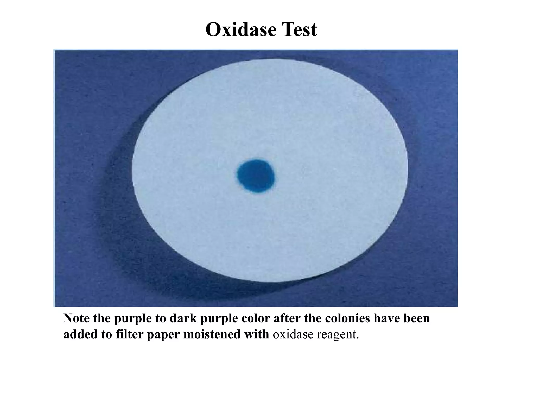 Oxidase Test




Note the purple to dark purple color after the colonies have been
added to filter paper moistened with oxidase reagent.
 