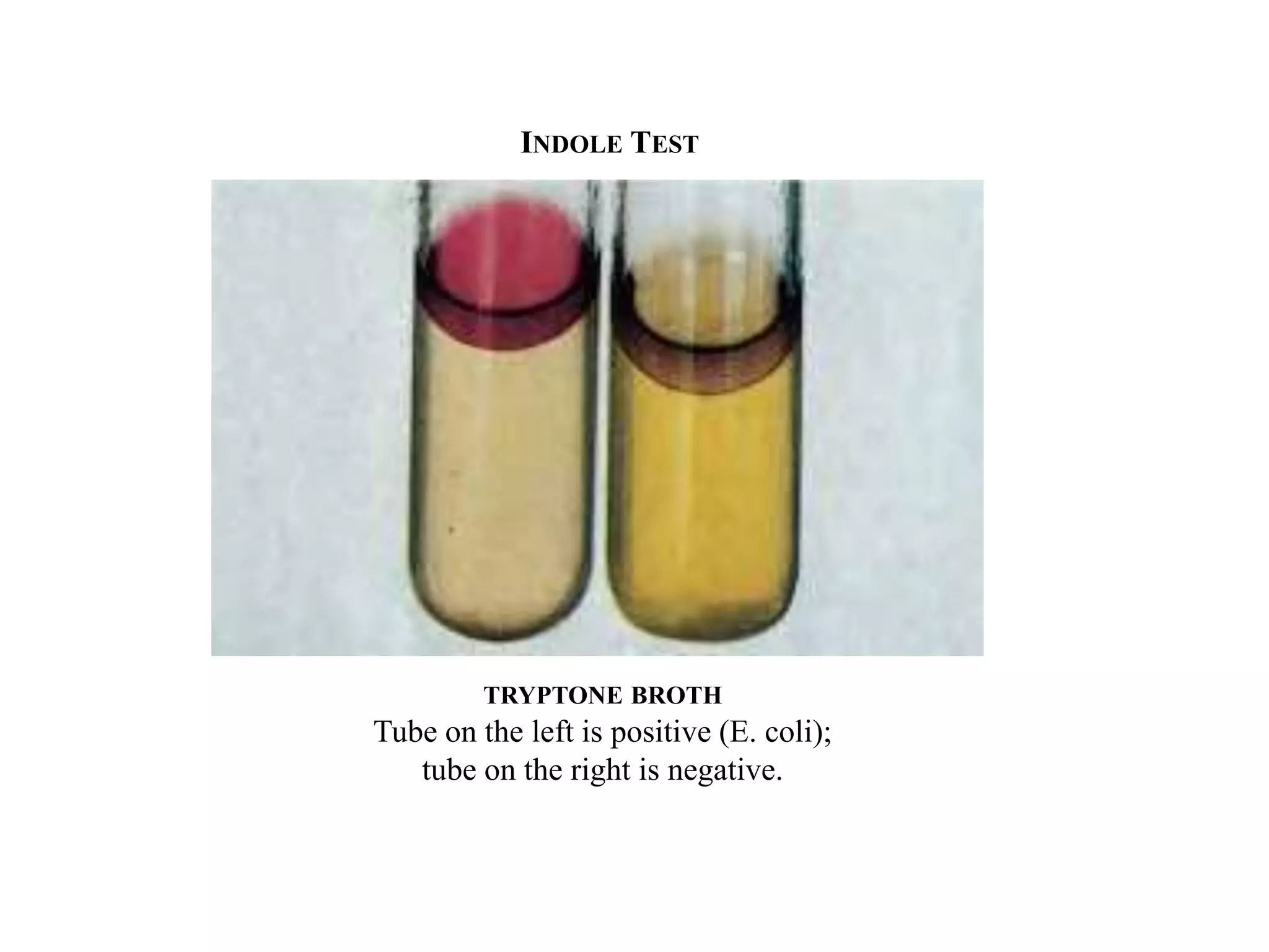 INDOLE TEST




         TRYPTONE BROTH
Tube on the left is positive (E. coli);
   tube on the right is negative.
 