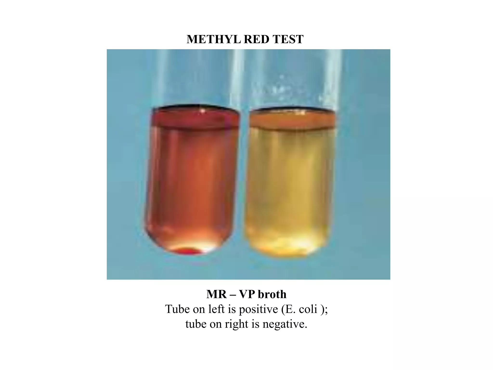 METHYL RED TEST




       MR – VP broth
Tube on left is positive (E. coli );
   tube on right is negative.
 