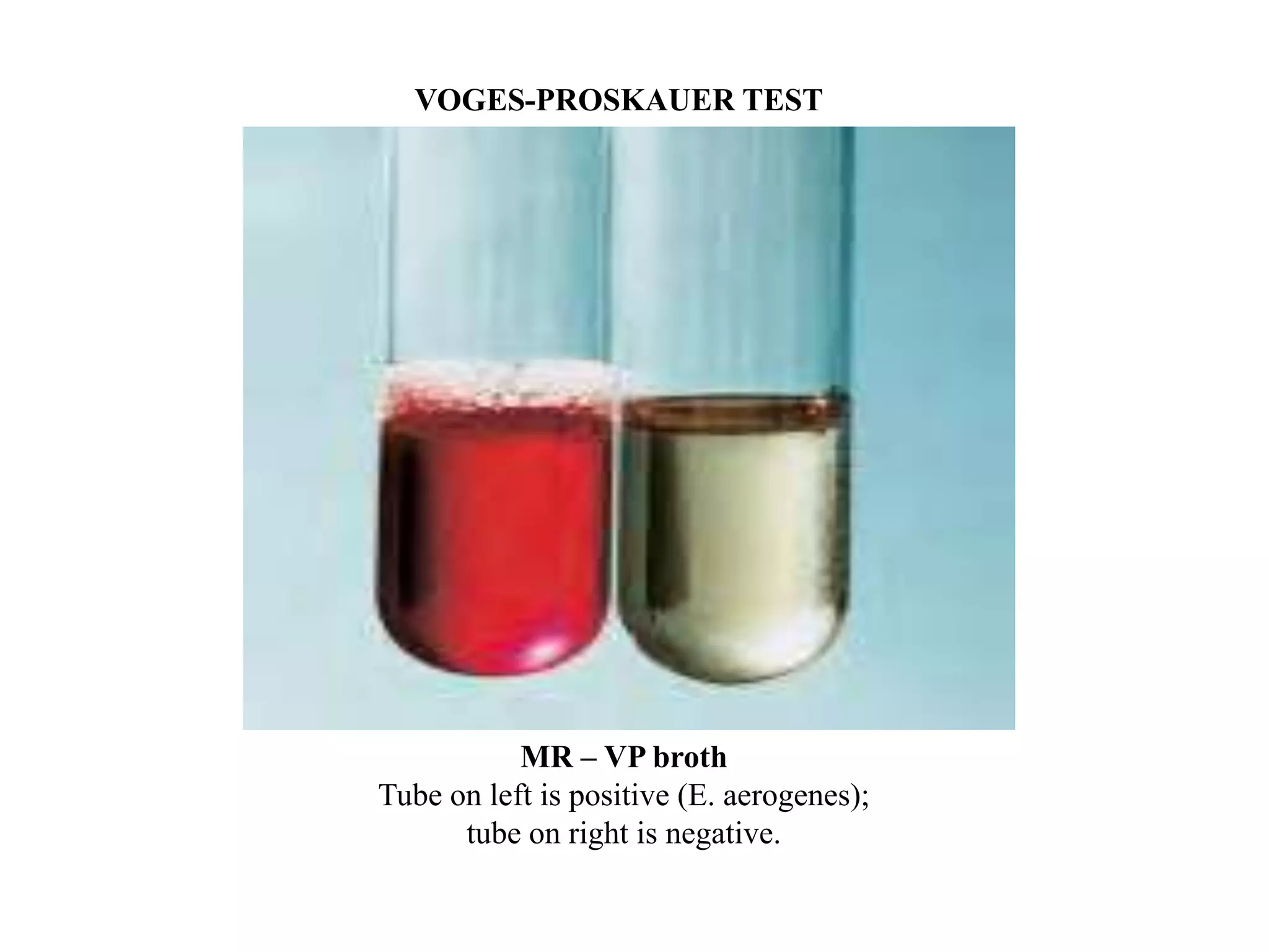VOGES-PROSKAUER TEST




           MR – VP broth
Tube on left is positive (E. aerogenes);
      tube on right is negative.
 