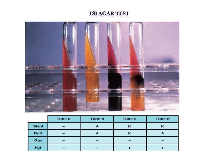 Biochemical test of bacteria