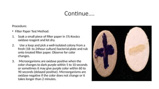 Biochemical test of bacteria. Informatio | PPTX