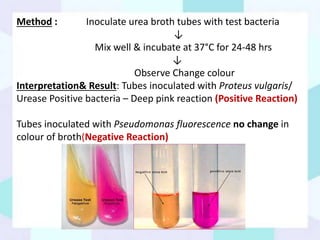 Biochemical tests and serological tests for bacterial disease diagnosis ...