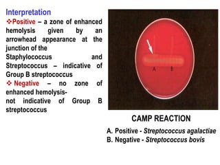 A) The CAMP test for identification of Group B streptococcus