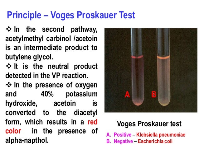 Biochemical tests for identification of bacteria