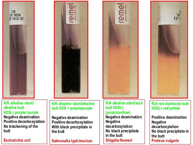 Biochemical tests for identification of bacteria