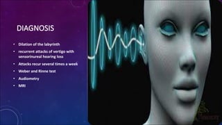 Rinner Abnormal Ménière’s disease Ömer aslankan | PDF